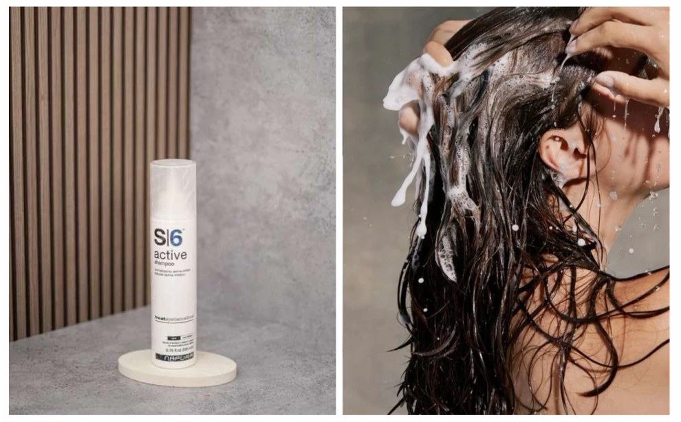 Як позбутися лупи